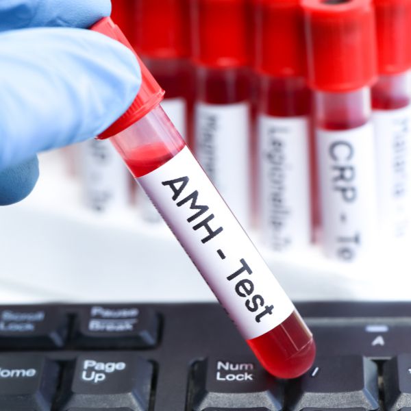 DỰ TRỮ BUỒNG TRỨNG THẤP (AMH) SUY BUỒNG TRỨNG