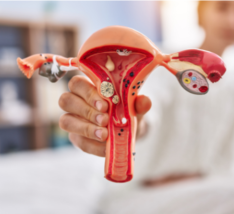 TẮC 1&nbsp; HOẶC 2 BÊN VÒI TRỨNG