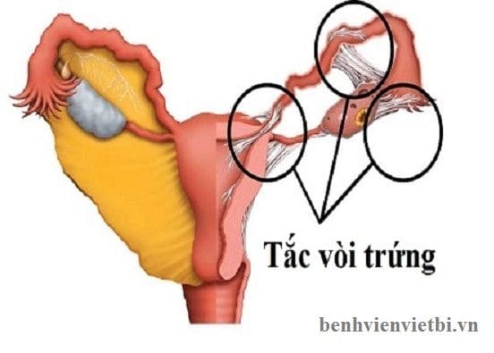 [:vi]Khám vô sinh cần khám những gì?[:]